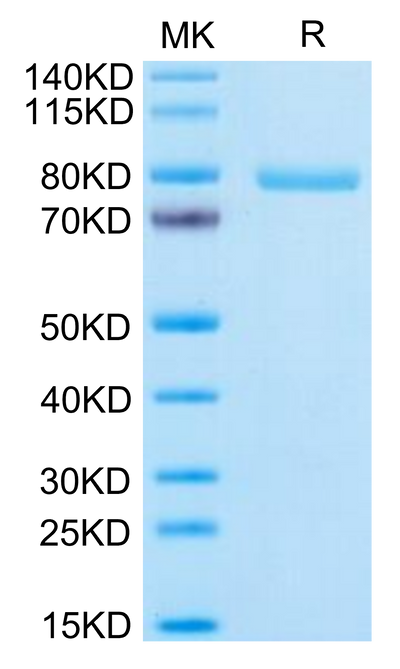 Human Notch 3 on Tris-Bis PAGE under reduced condition. The purity is greater than 95%.Recombinant Human Notch 3 Protein