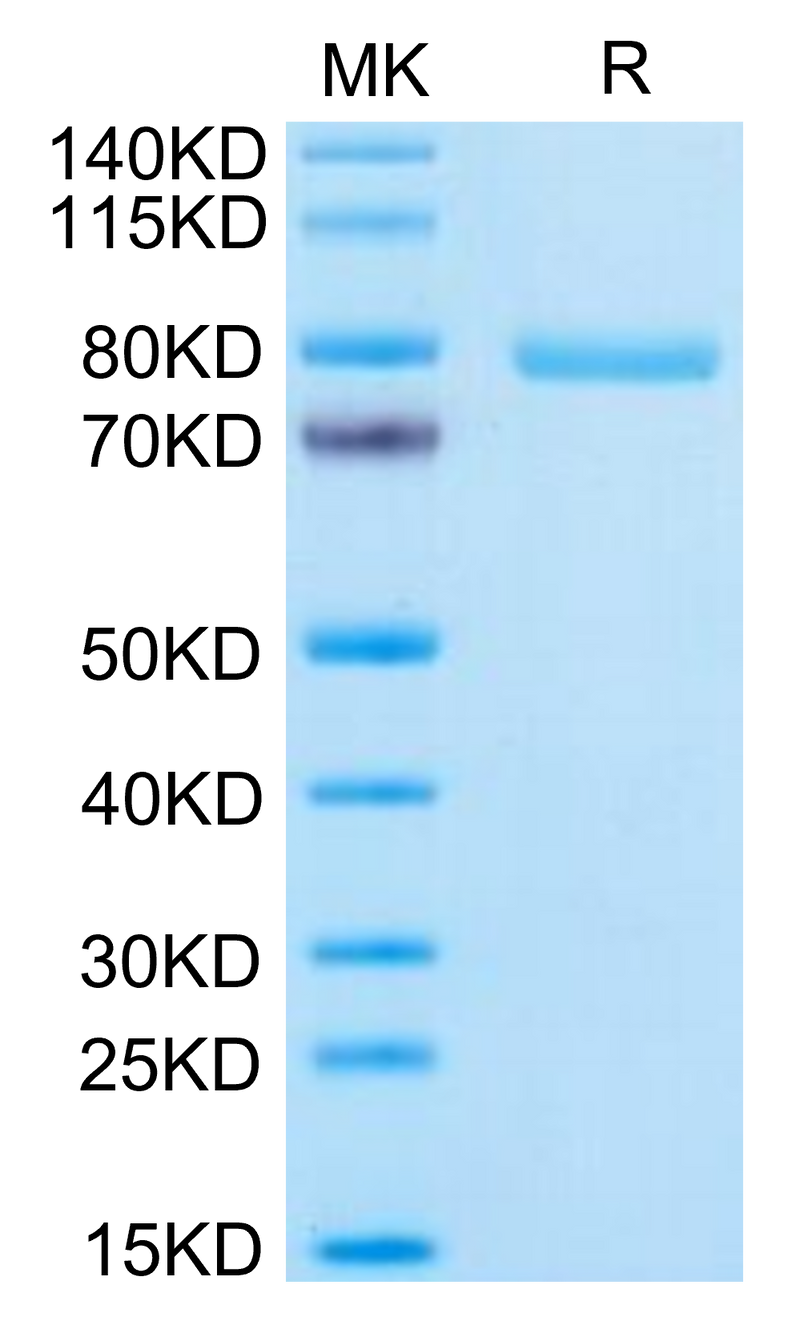 Human Notch 3 on Tris-Bis PAGE under reduced condition. The purity is greater than 95%.Recombinant Human Notch 3 Protein