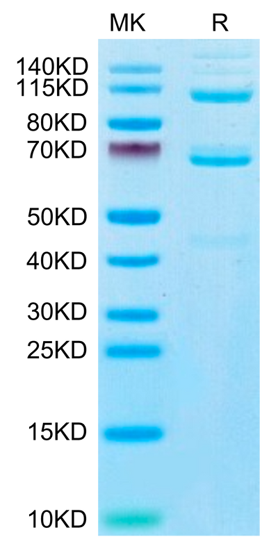 Human Complement component 3 on Tris-Bis PAGE under reduced condition. The purity is greater than 95%.Recombinant Human Complement component 3 Protein