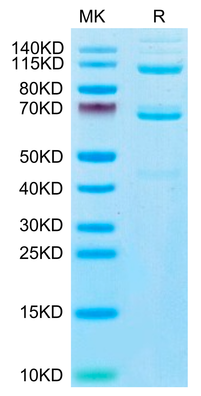 Human Complement component 3 on Tris-Bis PAGE under reduced condition. The purity is greater than 95%.Recombinant Human Complement component 3 Protein