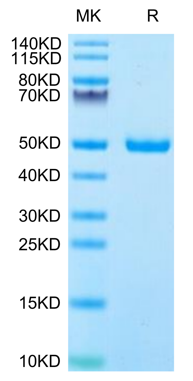 Human IFN alpha 1 on Tris-Bis PAGE under reduced condition. The purity is greater than 95%.Recombinant Human IFN alpha 1 Protein, Active