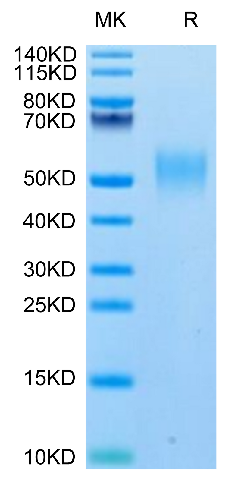 Biotinylated Human SLAMF1 on Tris-Bis PAGE under reduced condition. The purity is greater than 95%.Biotinylated Human SLAMF1/SLAM/CD150 Protein