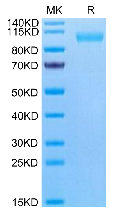 Human CD9P1 on Tris-Bis PAGE under reduced condition. The purity is greater than 95%.Recombinant Human CD9P1 Protein