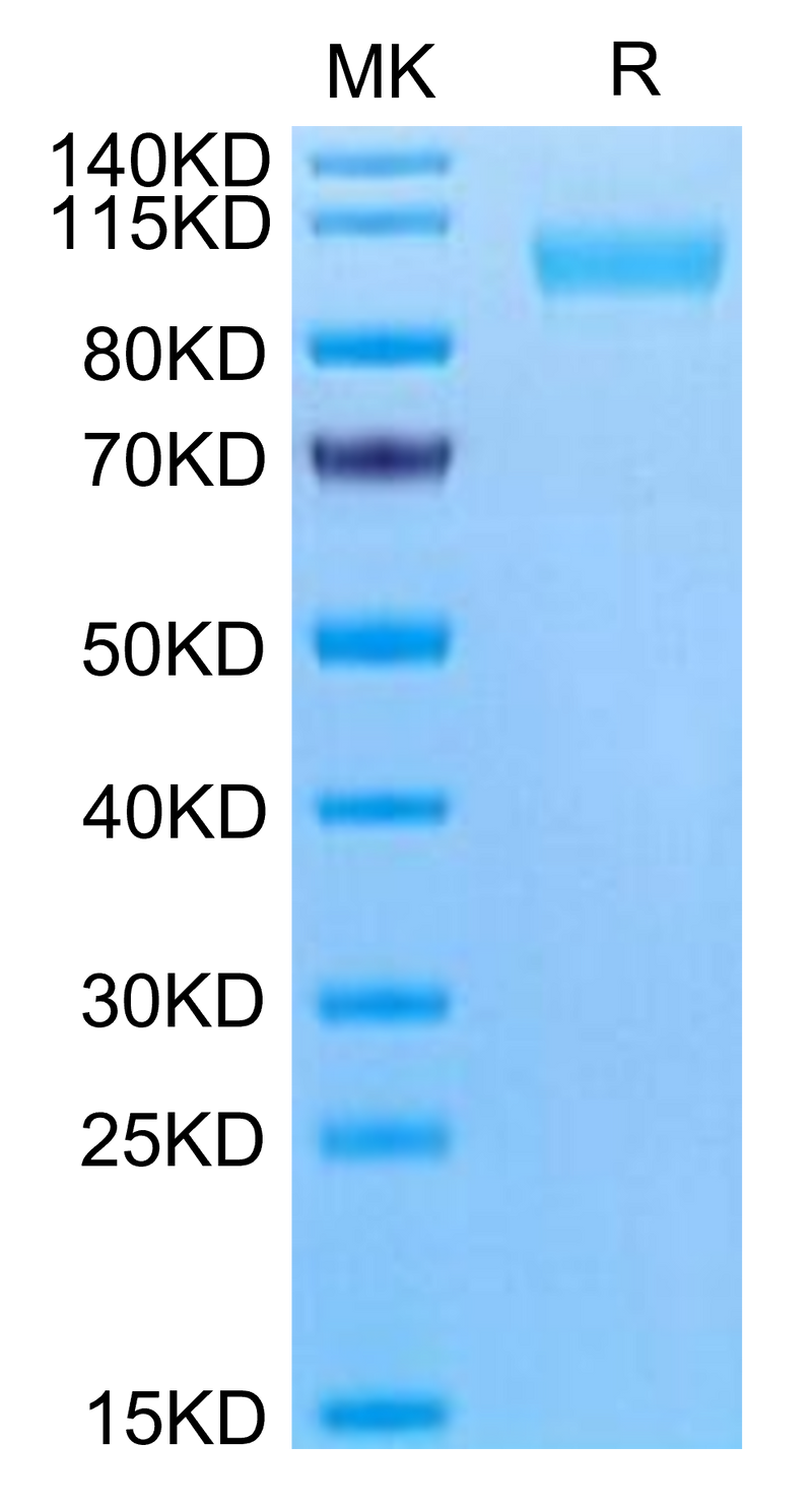 Human CD9P1 on Tris-Bis PAGE under reduced condition. The purity is greater than 95%.Recombinant Human CD9P1 Protein