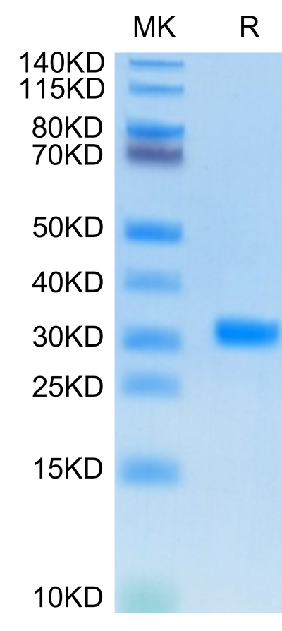 SARS-CoV-2 3CLpro on Tris-Bis PAGE under reduced condition. The purity is greater than 95%.Recombinant SARS-CoV-2 3CLpro/3C-like Protease Protein
