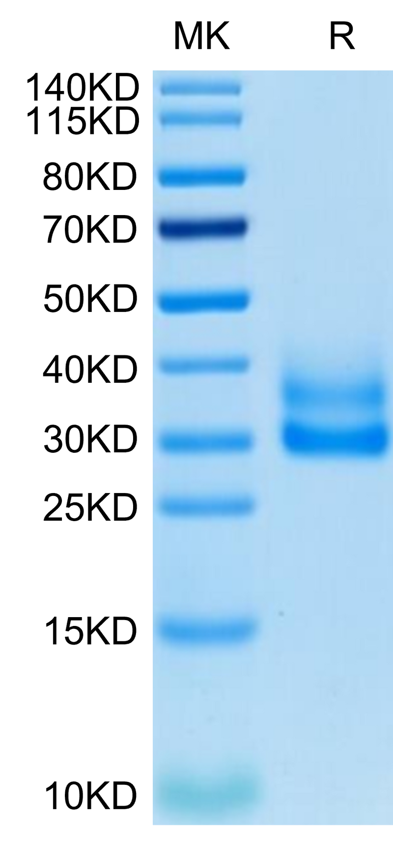 Cynomolgus/Rhesus macaque 4-1BB on Tris-Bis PAGE under reduced condition. The purity is greater than 95%.Recombinant Cynomolgus/Rhesus macaque 4-1BB/TNFRSF9 Protein, Active