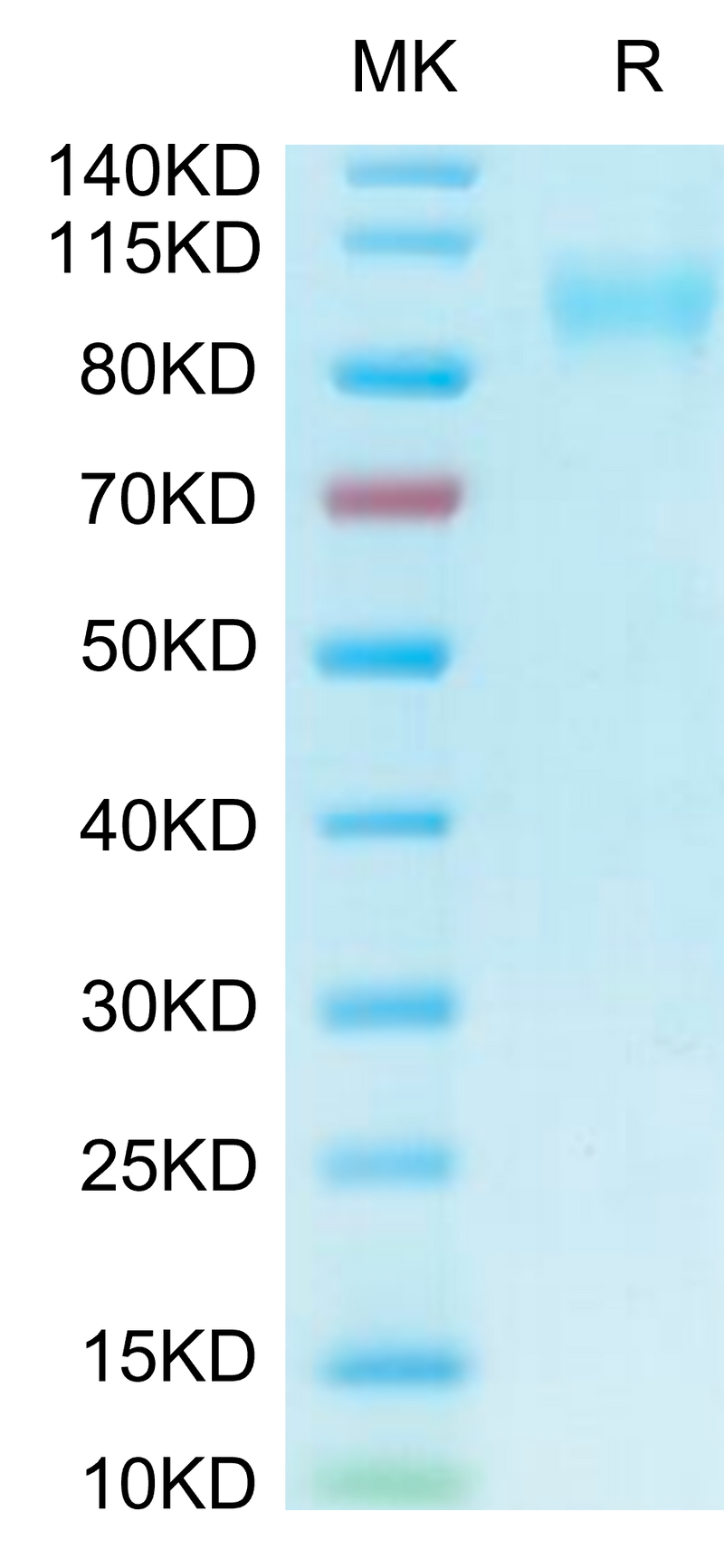 Biotinylated Human ACE2 on Tris-Bis PAGE under reduced condition. The purity is greater than 95%.Biotinylated Human ACE2/ACEH Protein, Active