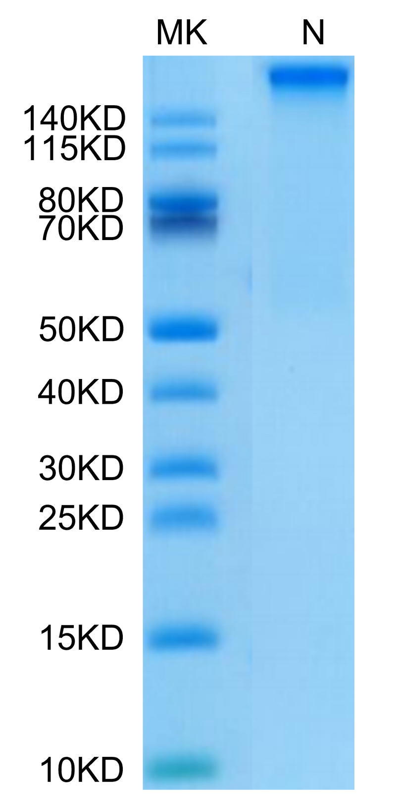 Human HLA-A*11:01&B2M&KRAS G12D (VVVGADGVGK) Tetramer on Tris-Bis PAGE under Non reducing (N) condition. The purity is greater than 95%.Recombinant Human HLA-A*11:01&B2M&KRAS G12D (VVVGADGVGK) Tetramer Protein, Active
