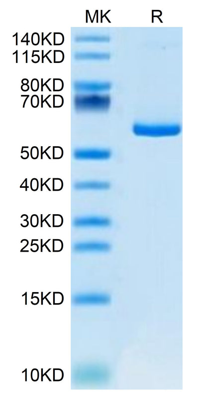 Mouse APLN on Tris-Bis PAGE under reduced condition. The purity is greater than 95%.Recombinant Mouse APLN Protein