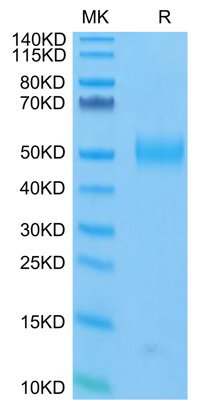 FITC-Labeled Human Siglec-3 on Tris-Bis PAGE under reduced condition. The purity is greater than 95%.Recombinant FITC-Labeled Human Siglec-3/CD33 Protein