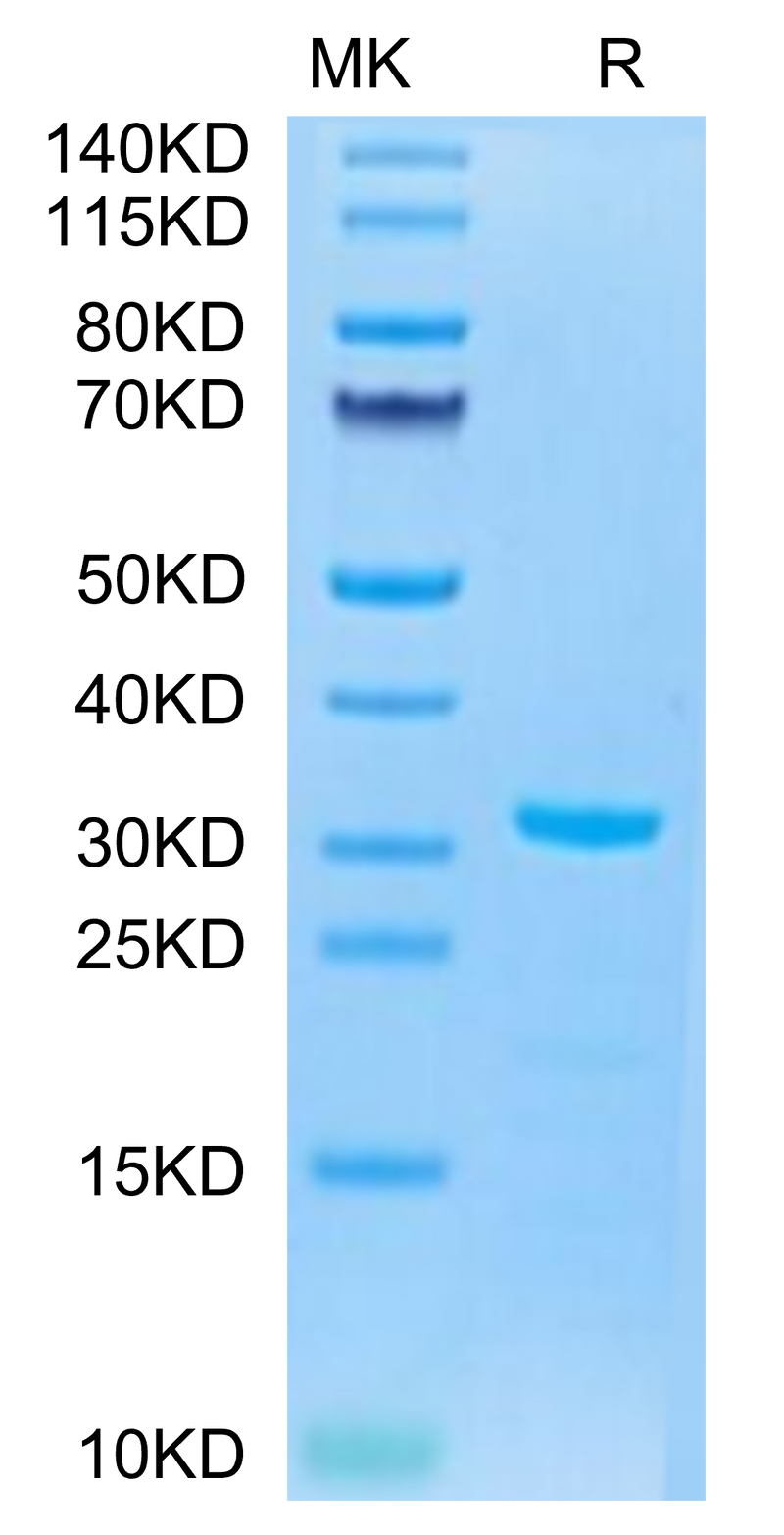 Biotinylated Mouse PLAU on Tris-Bis PAGE under reduced condition. The purity is greater than 95%.Biotinylated Mouse PLAU/uPA Protein, Active