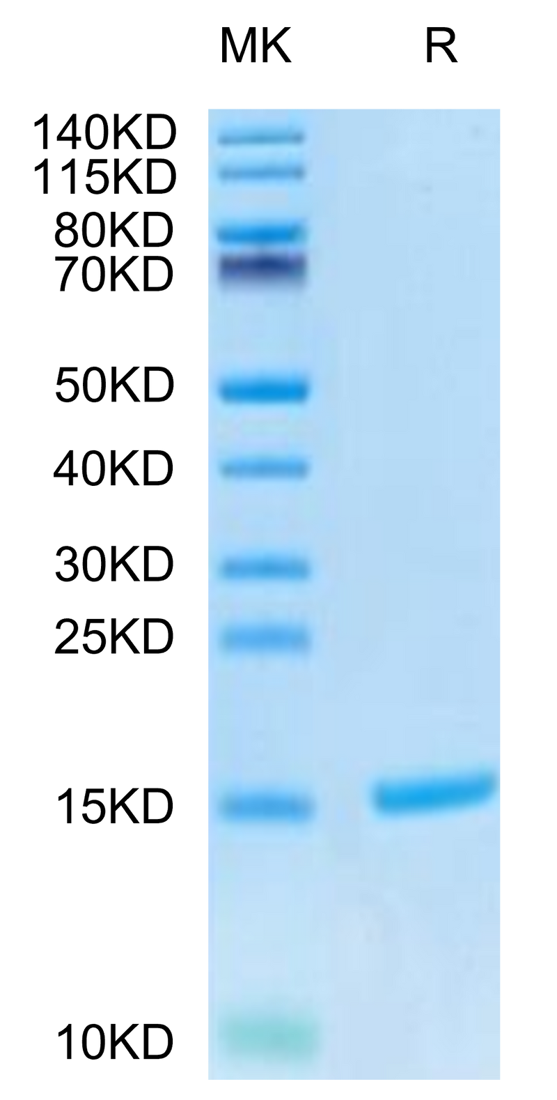 Cynomolgus S100A9 on Tris-Bis PAGE under reduced condition. The purity is greater than 95%.Recombinant Cynomolgus S100A9/MRP14 Protein