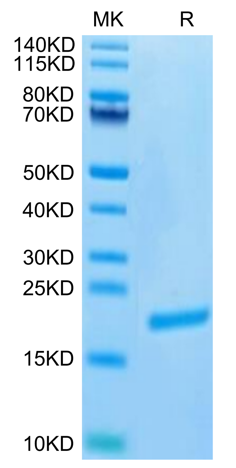 Biotinylated Human FGF-7 on Tris-Bis PAGE under reduced condition. The purity is greater than 95%.Biotinylated Human FGF-7/KGF Protein (Primary Amine Labeling)