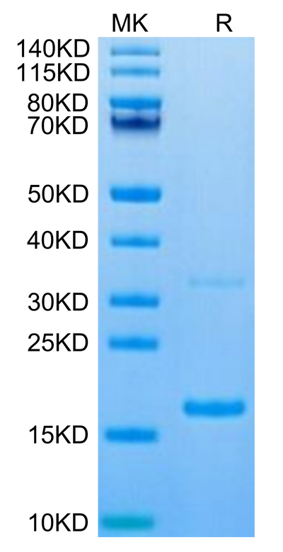 Canine S100A9 on Tris-Bis PAGE under reduced condition. The purity is greater than 95%.Recombinant Canine S100A9/MRP14 Protein