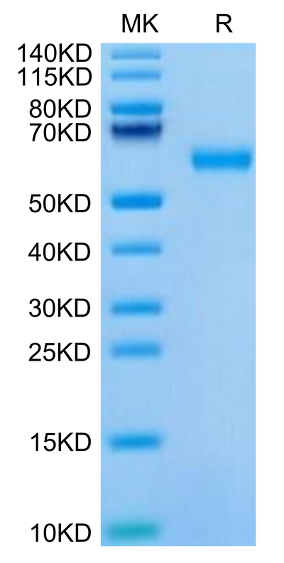 Mouse ROR1 on Tris-Bis PAGE under reduced condition. The purity is greater than 95%.Recombinant Mouse ROR1 Protein