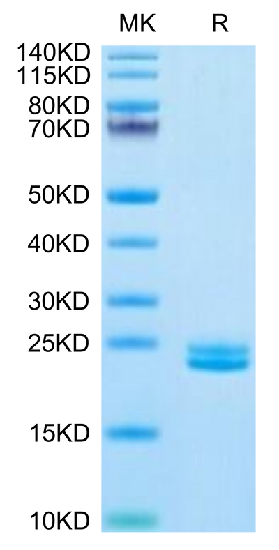 Human IL-11 on Tris-Bis PAGE under reduced condition. The purity is greater than 95%.Recombinant Human IL-11 Protein, Active