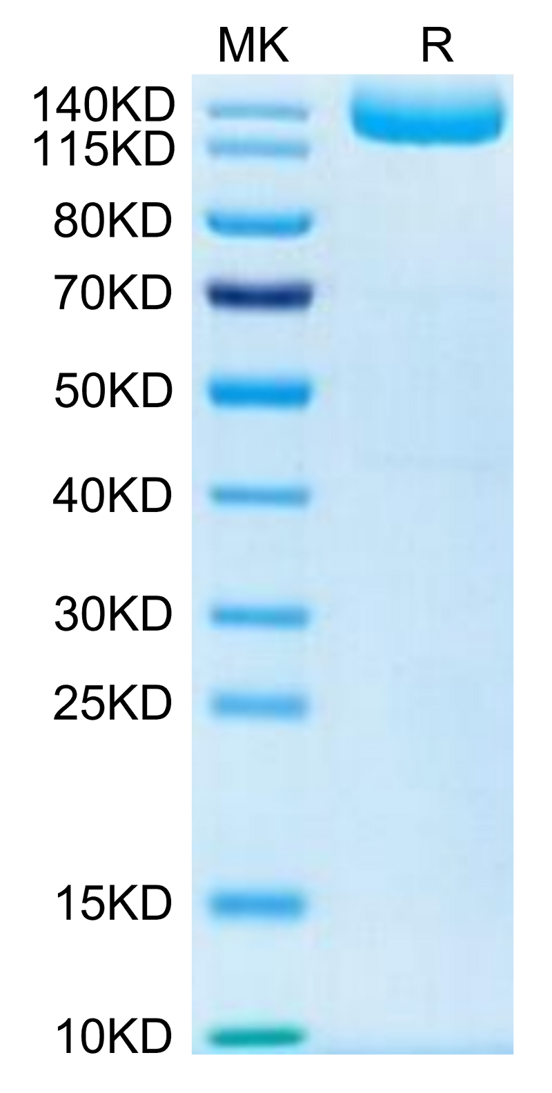 Human LIF R on Tris-Bis PAGE under reduced condition. The purity is greater than 95%.Recombinant Human LIF R/CD118 Protein, Active