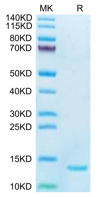 Human DDT on Tris-Bis PAGE under reduced condition. The purity is greater than 95%.Recombinant Human DDT Protein