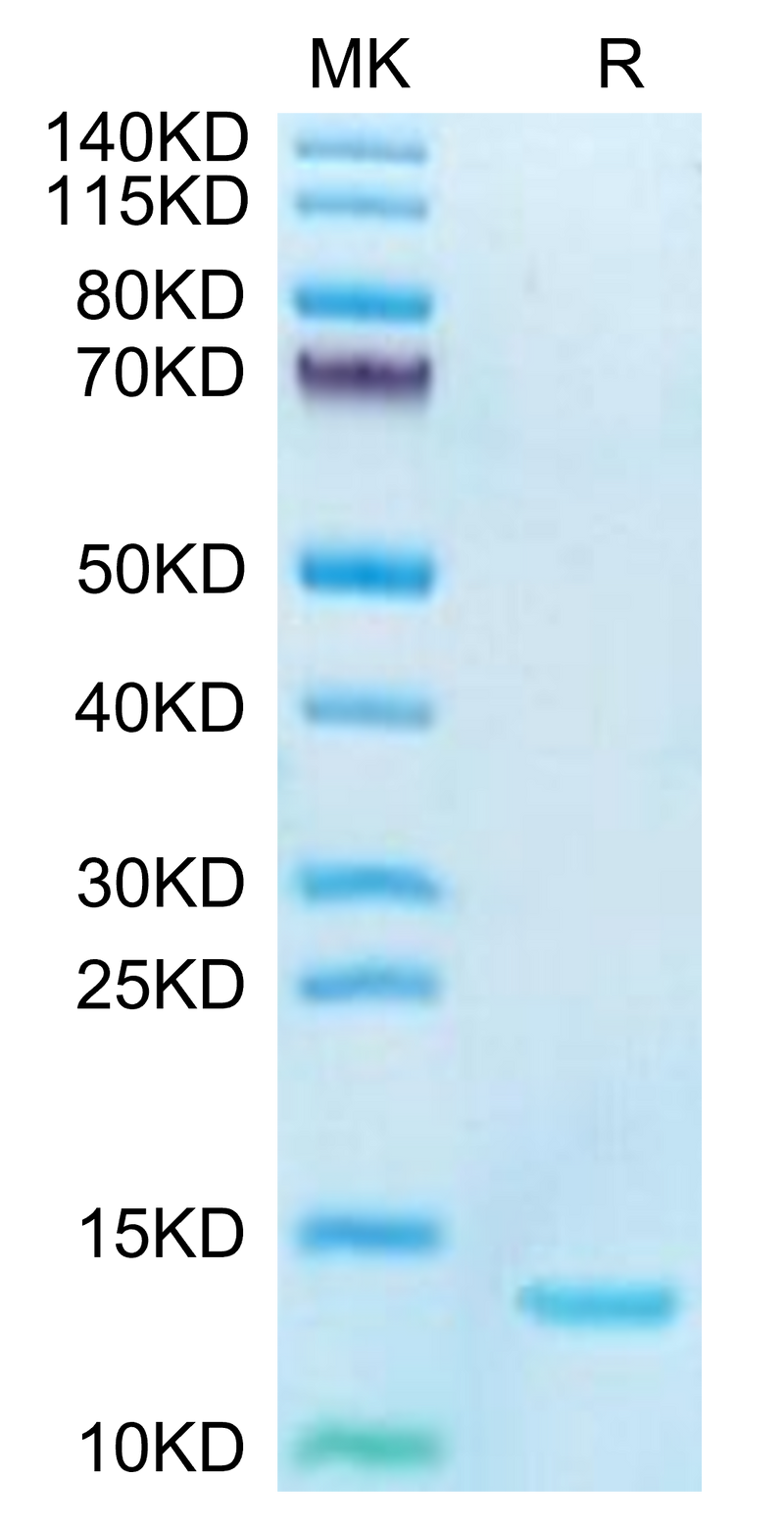 Human DDT on Tris-Bis PAGE under reduced condition. The purity is greater than 95%.Recombinant Human DDT Protein