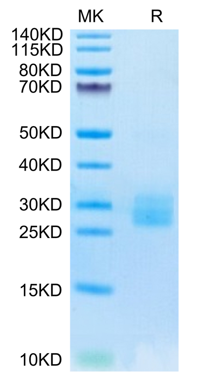 Biotinylated Human IL-25 on Tris-Bis PAGE under reduced condition. The purity is greater than 95%.Biotinylated Human IL-25/IL-17E Protein, Active