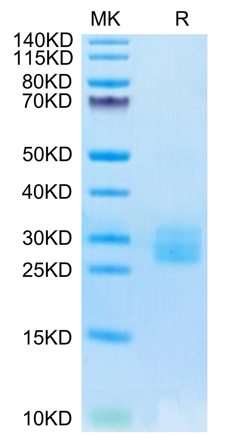 Biotinylated Human IL-25 on Tris-Bis PAGE under reduced condition. The purity is greater than 95%.Biotinylated Human IL-25/IL-17E Protein, Active