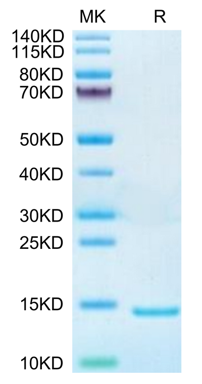 Mouse DDT on Tris-Bis PAGE under reduced condition. The purity is greater than 95%.Recombinant Mouse DDT Protein