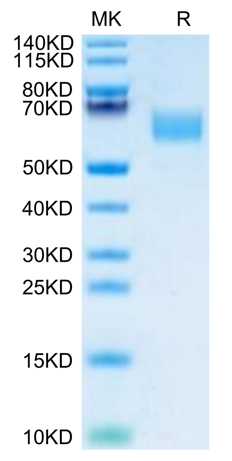 Mouse CD47 on Tris-Bis PAGE under reduced condition. The purity is greater than 95%.Recombinant Mouse CD47 Protein, Active