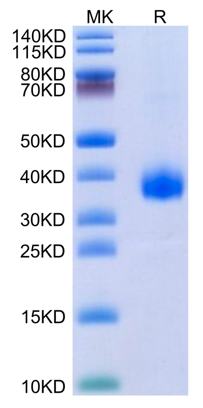 SARS-Cov-2 Spike RBD (B.1.640.2/IHU) on Tris-Bis PAGE under reduced condition. The purity is greater than 95%.Recombinant SARS-Cov-2 Spike RBD (B.1.640.2/IHU) Protein, Active
