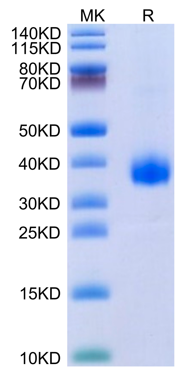SARS-Cov-2 Spike RBD (B.1.640.2/IHU) on Tris-Bis PAGE under reduced condition. The purity is greater than 95%.Recombinant SARS-Cov-2 Spike RBD (B.1.640.2/IHU) Protein, Active