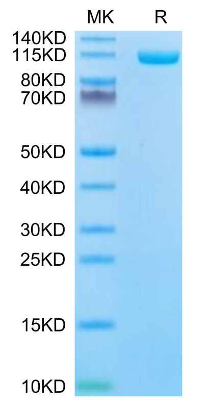 Biotinylated Human ENPP-1 on Tris-Bis PAGE under reduced condition. The purity is greater than 95%.Biotinylated Human ENPP-1 Protein, Active