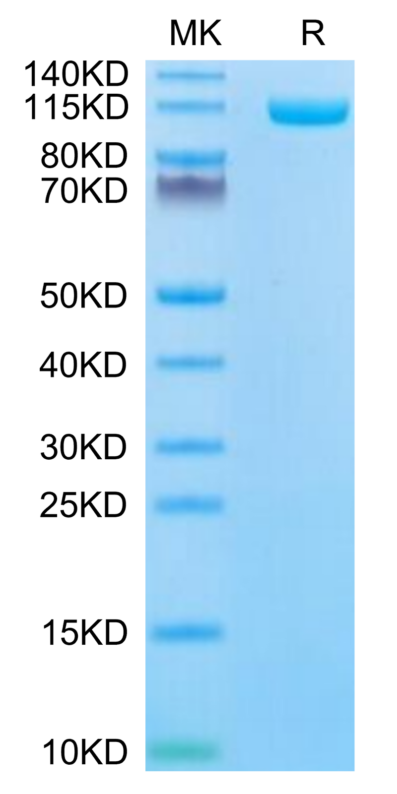Biotinylated Human ENPP-1 on Tris-Bis PAGE under reduced condition. The purity is greater than 95%.Biotinylated Human ENPP-1 Protein, Active