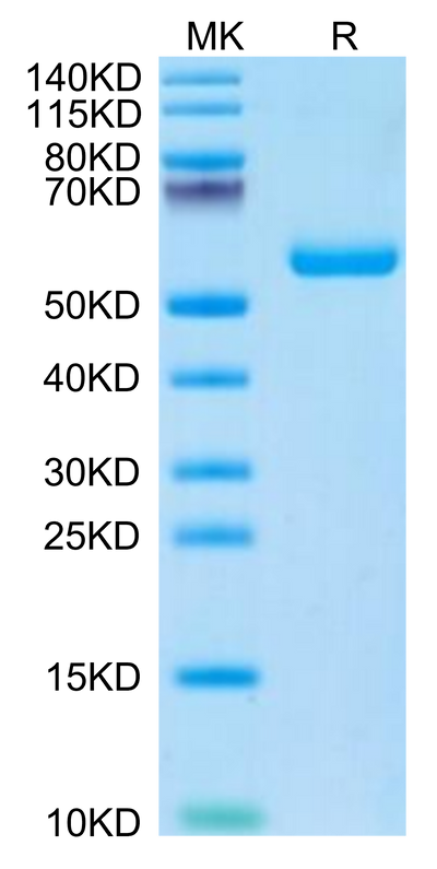 Mouse TIMP1 on Tris-Bis PAGE under reduced condition. The purity is greater than 95%.Recombinant Mouse TIMP1 Protein
