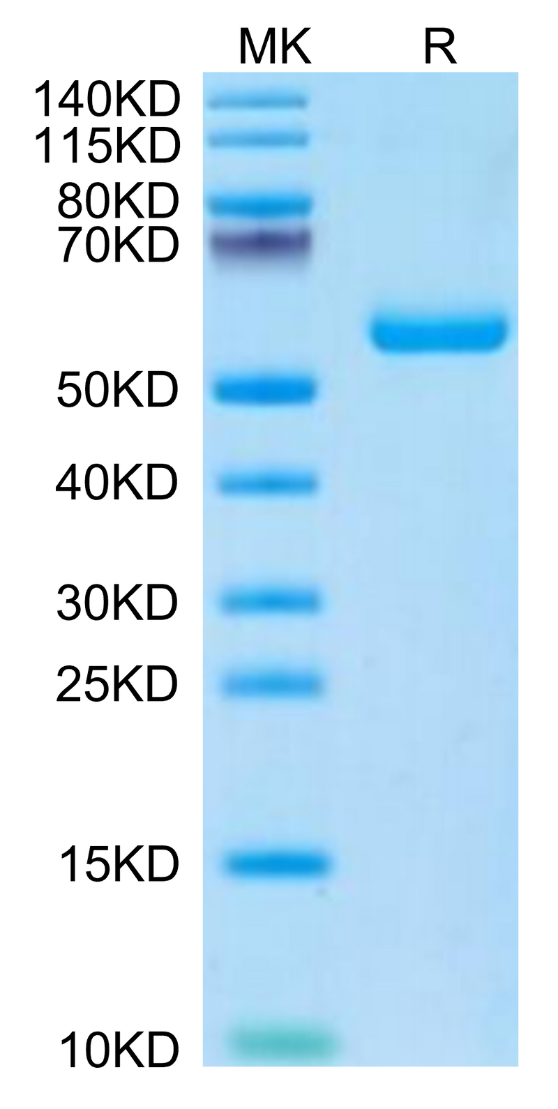 Mouse TIMP1 on Tris-Bis PAGE under reduced condition. The purity is greater than 95%.Recombinant Mouse TIMP1 Protein