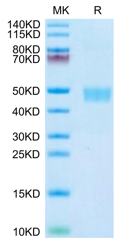 Mouse CD59a on Tris-Bis PAGE under reduced condition. The purity is greater than 95%.Recombinant Mouse CD59a Protein