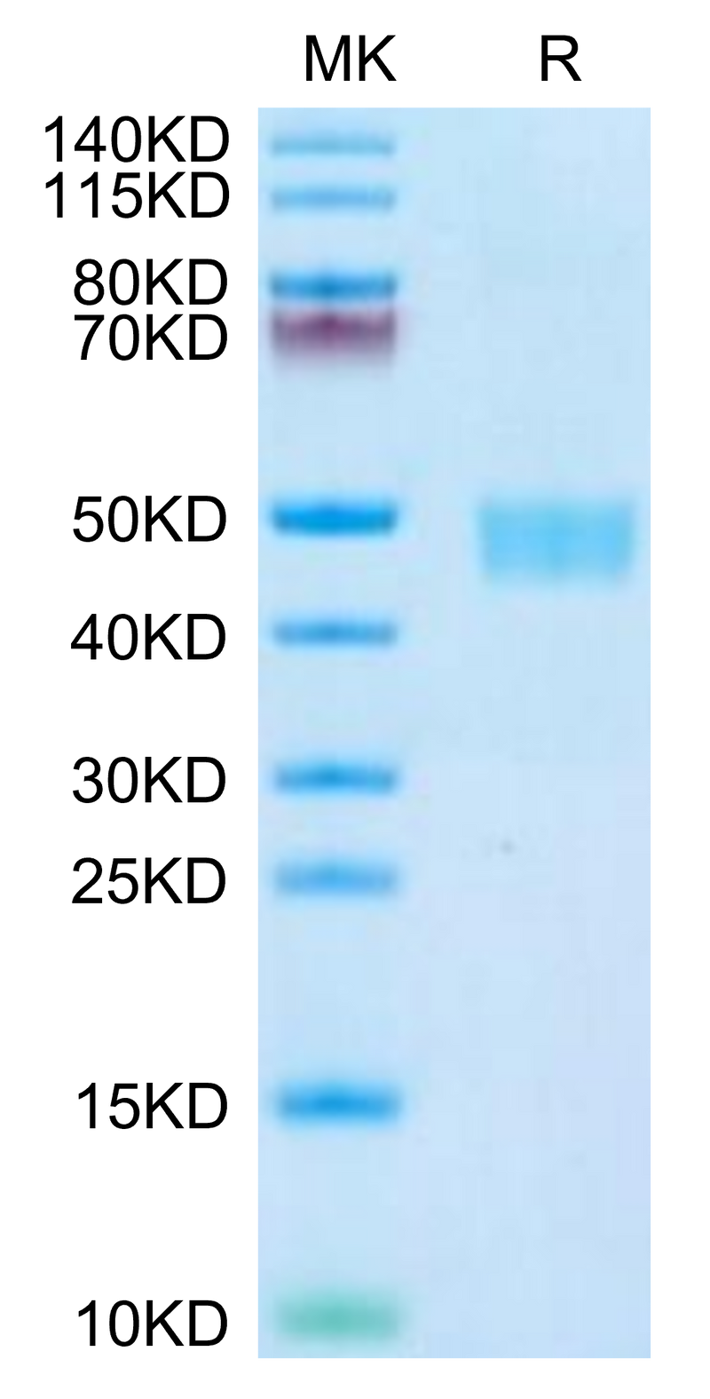 Mouse CD59a on Tris-Bis PAGE under reduced condition. The purity is greater than 95%.Recombinant Mouse CD59a Protein