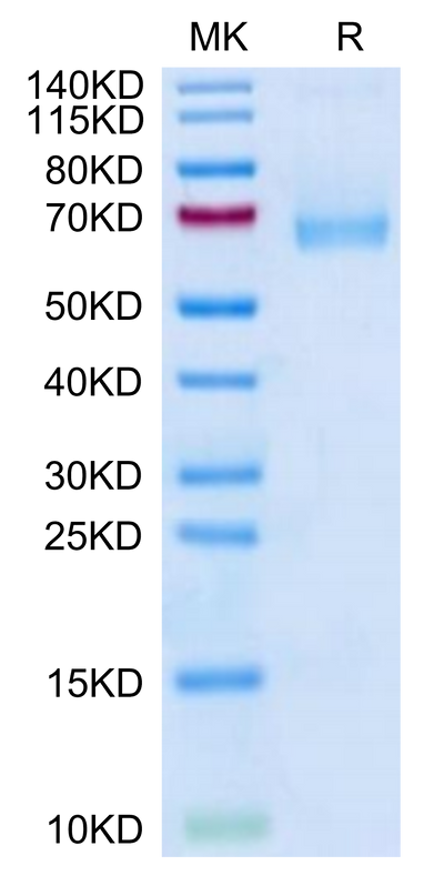 Mouse IL-7R alpha on Tris-Bis PAGE under reduced condition. The purity is greater than 95%.Recombinant Mouse IL-7R alpha/CD127 Protein, Active