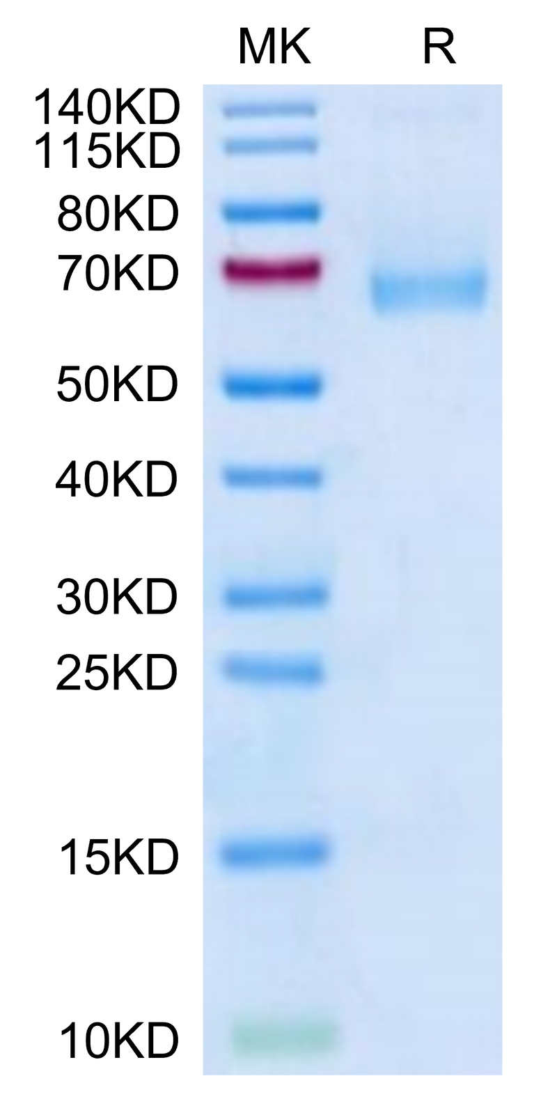 Mouse IL-7R alpha on Tris-Bis PAGE under reduced condition. The purity is greater than 95%.Recombinant Mouse IL-7R alpha/CD127 Protein, Active
