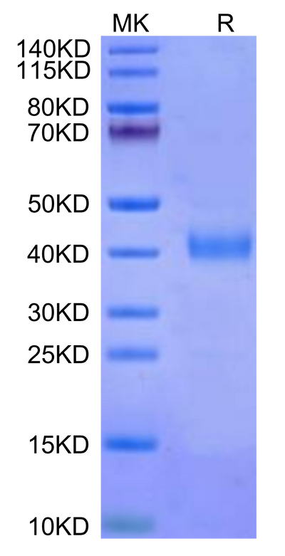 Cynomolgus IL-2 R beta on Tris-Bis PAGE under reduced conditions. The purity is greater than 95%.Recombinant Cynomolgus IL-2 R beta/CD122 Protein, Active