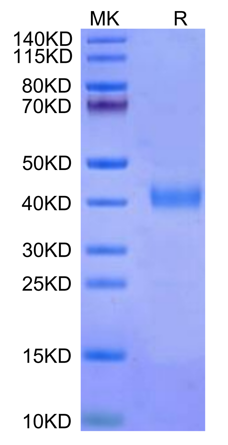 Cynomolgus IL-2 R beta on Tris-Bis PAGE under reduced conditions. The purity is greater than 95%.Recombinant Cynomolgus IL-2 R beta/CD122 Protein, Active