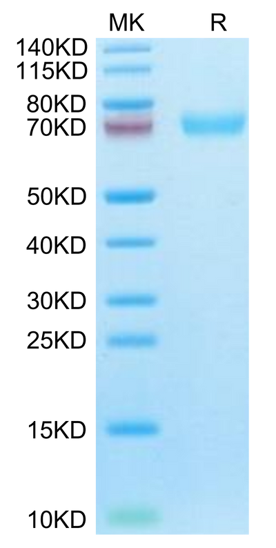 Cynomolgus LILRA6 on Tris-Bis PAGE under reduced condition. The purity is greater than 95%.Recombinant Cynomolgus LILRA6/CD85b/ILT8 Protein