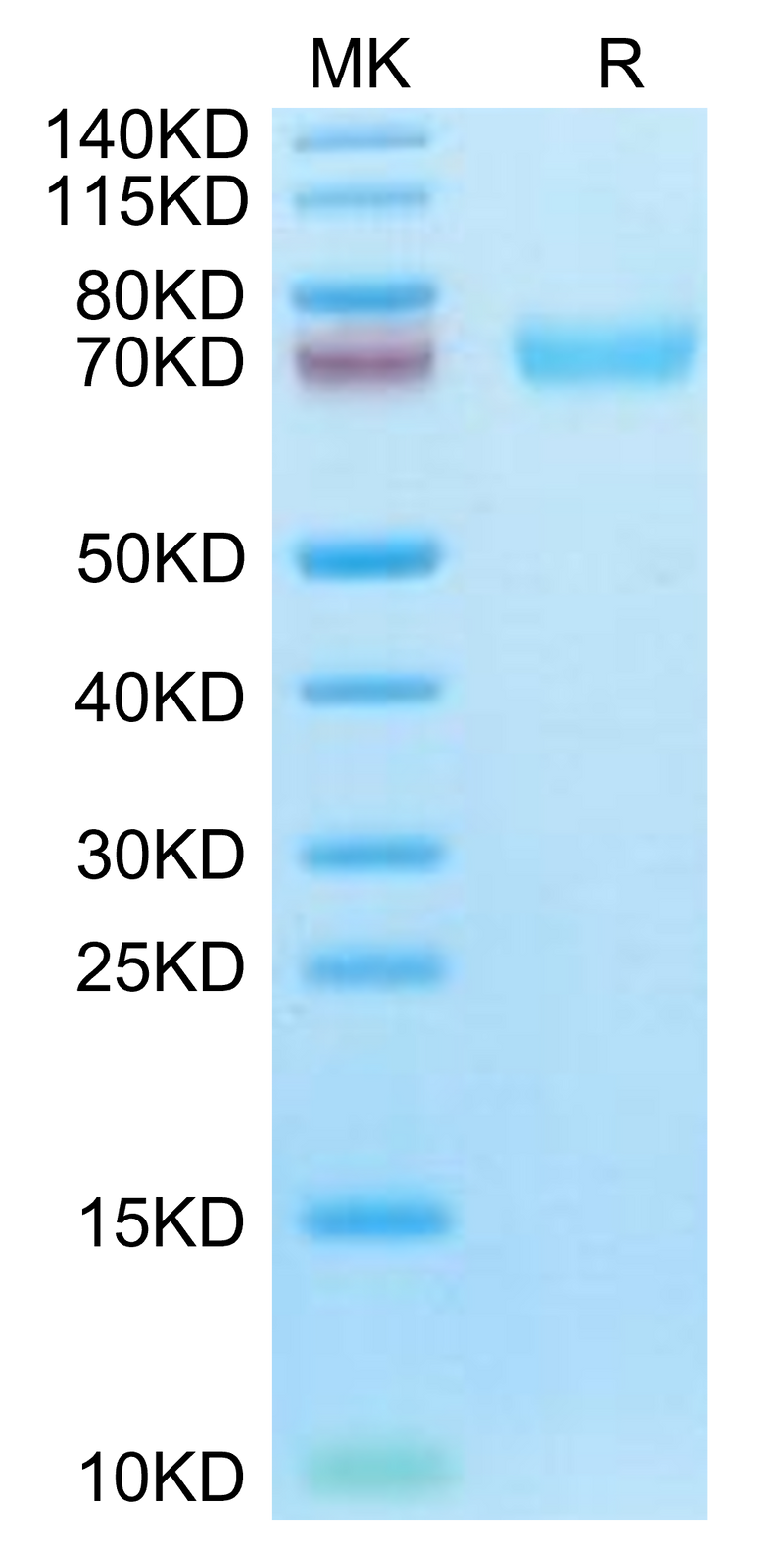 Cynomolgus LILRA6 on Tris-Bis PAGE under reduced condition. The purity is greater than 95%.Recombinant Cynomolgus LILRA6/CD85b/ILT8 Protein