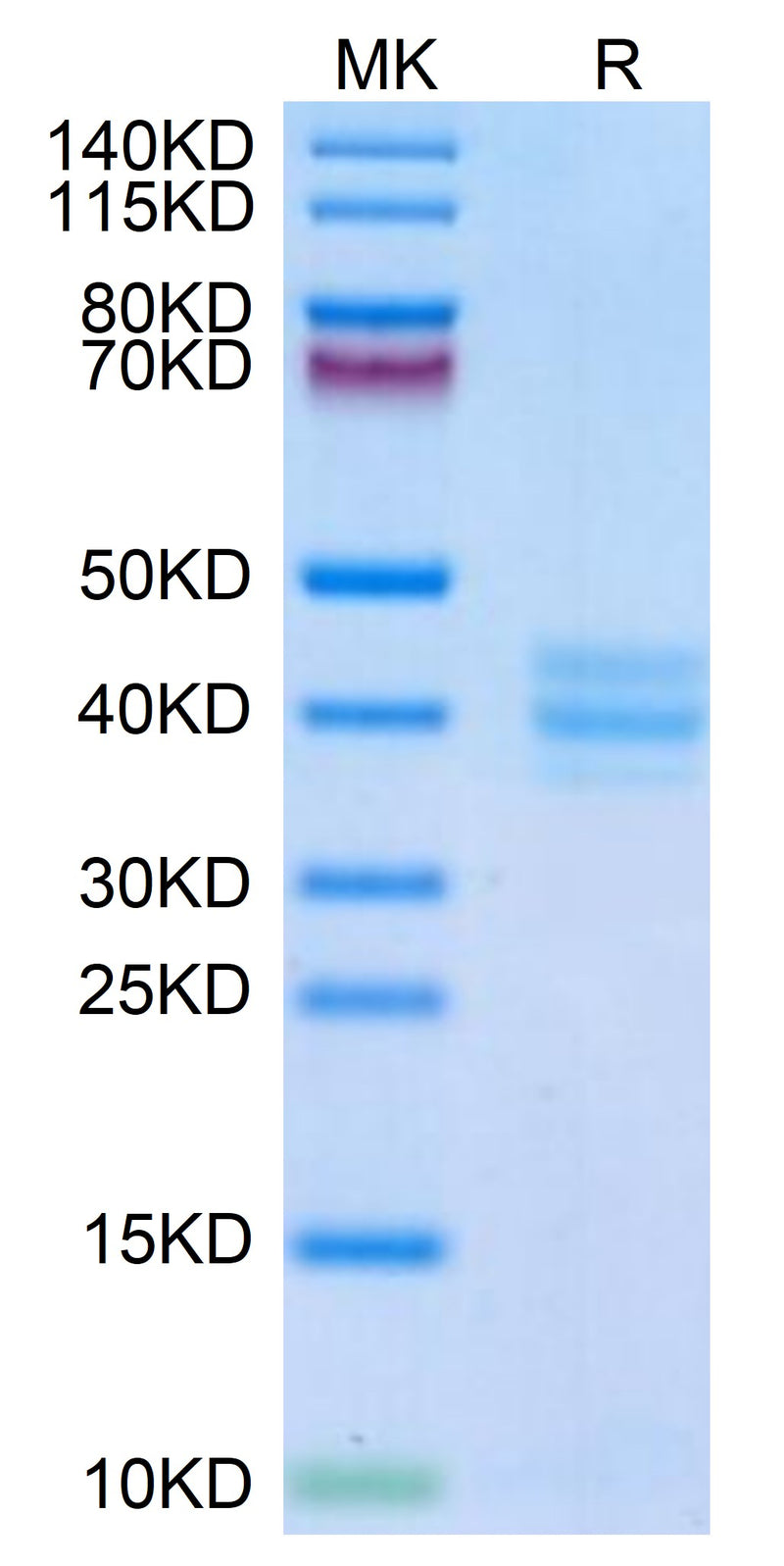 Mouse GPA33 on Tris-Bis PAGE under reduced condition. The purity is greater than 95%.Recombinant Mouse GPA33/A33 Protein