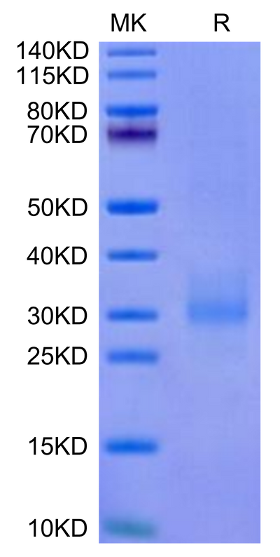 Cynomolgus NKG2A&CD94 on Tris-Bis PAGE under reduced condition. The purity is greater than 95%.Recombinant Cynomolgus NKG2A&CD94 Protein, Active