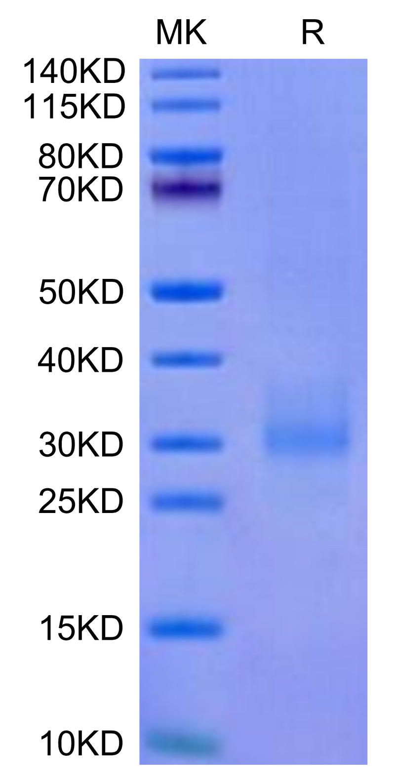Cynomolgus NKG2A&CD94 on Tris-Bis PAGE under reduced condition. The purity is greater than 95%.Recombinant Cynomolgus NKG2A&CD94 Protein, Active