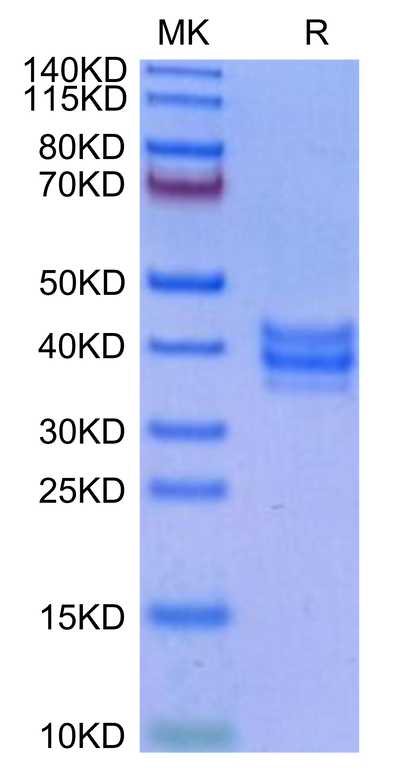 Cynomolgus NKG2C&CD94 on Tris-Bis PAGE under reduced condition. The purity is greater than 95%.Recombinant Cynomolgus NKG2C&CD94 Protein