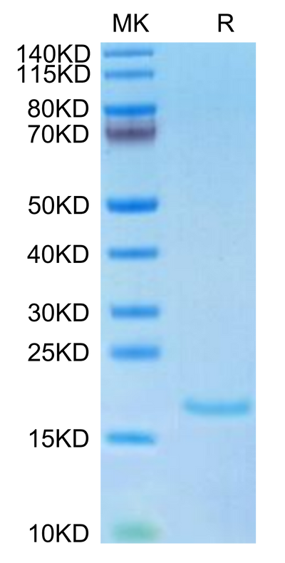 Human IL-10 on Tris-Bis PAGE under reduced condition. The purity is greater than 95%.Recombinant Human IL-10 Protein, Active