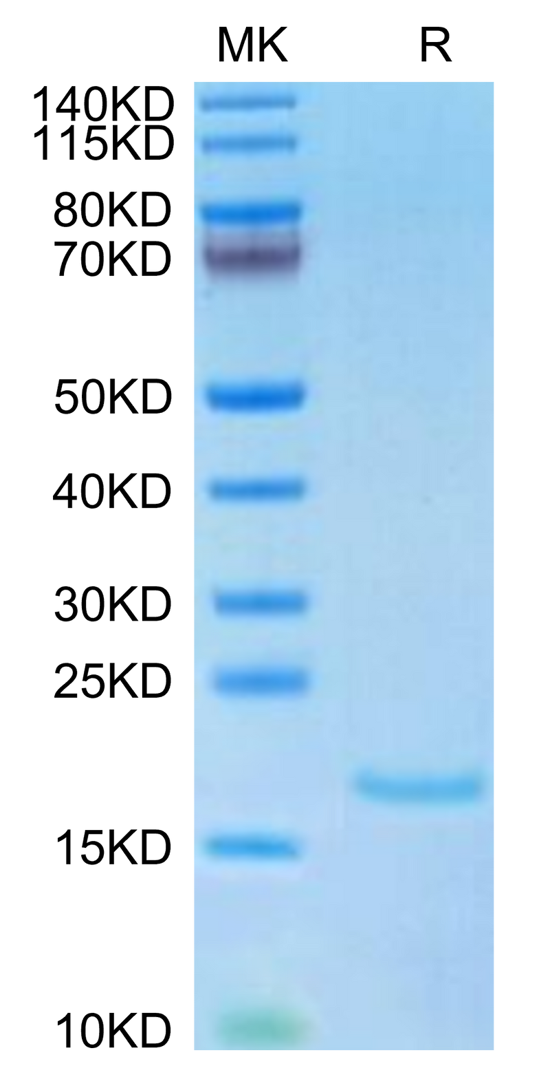 Human IL-10 on Tris-Bis PAGE under reduced condition. The purity is greater than 95%.Recombinant Human IL-10 Protein, Active