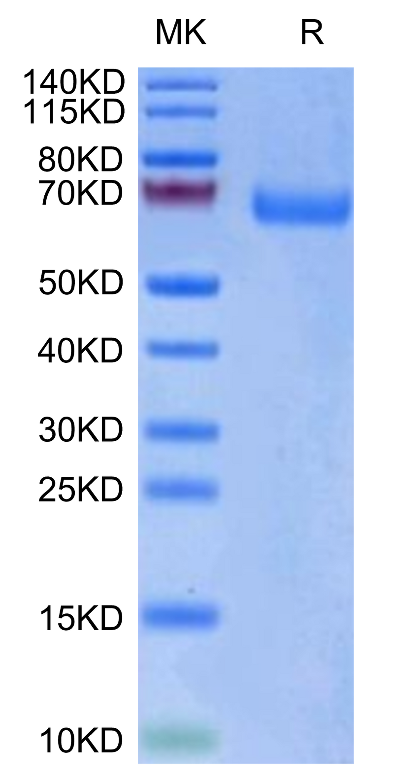 Biotinylated Human LILRA3 on Tris-Bis PAGE under reduced condition. The purity is greater than 95%.Biotinylated Human LILRA3/CD85e Protein