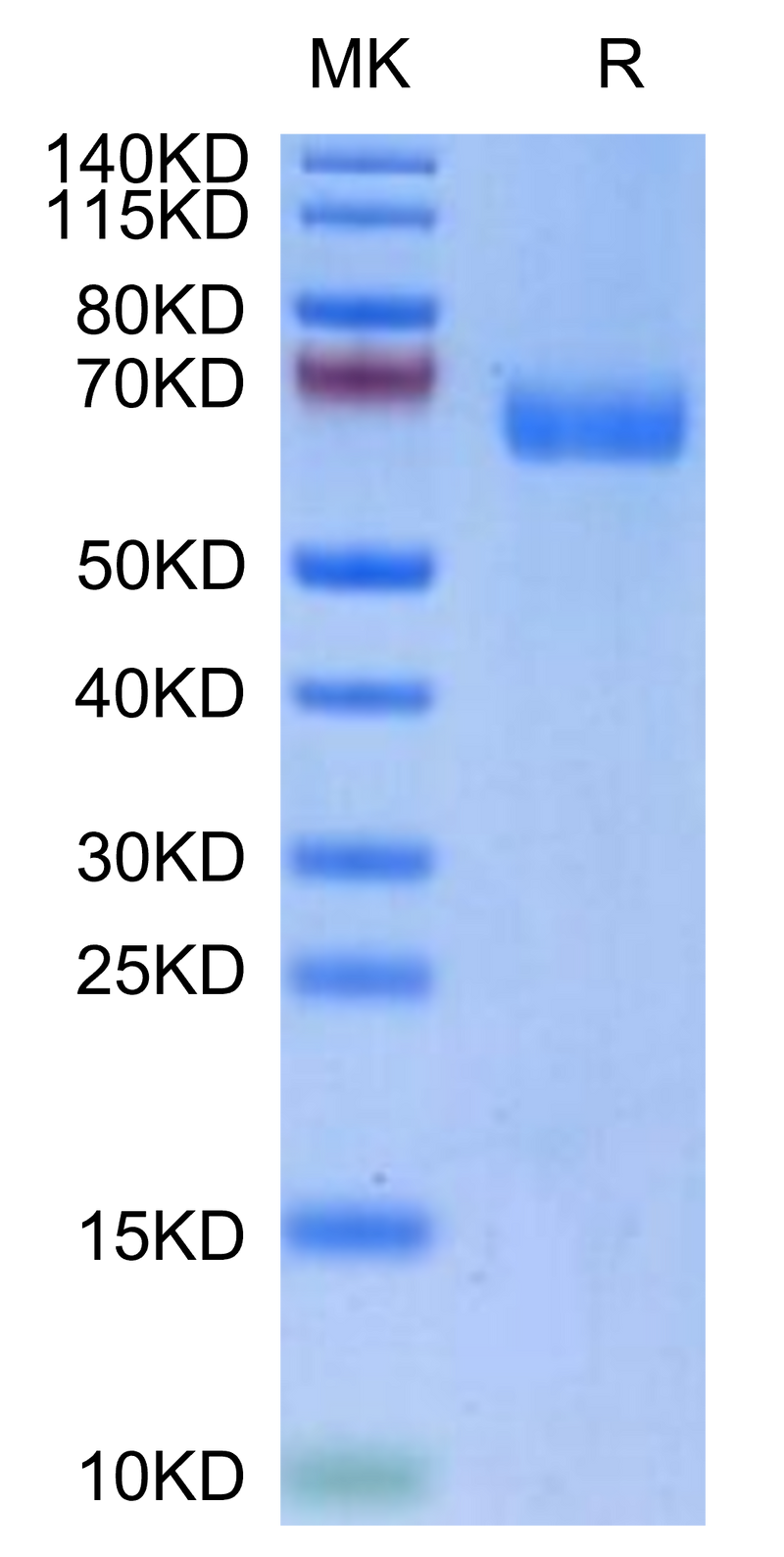 Biotinylated Human LILRA4 on Tris-Bis PAGE under reduced condition. The purity is greater than 95%.Biotinylated Human LILRA4/CD85g Protein