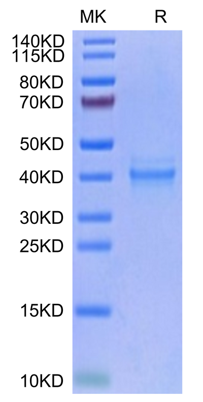 Human IL-12 on Tris-Bis PAGE under reduced condition. The purity is greater than 95%.Recombinant Human IL-12 Protein, Active
